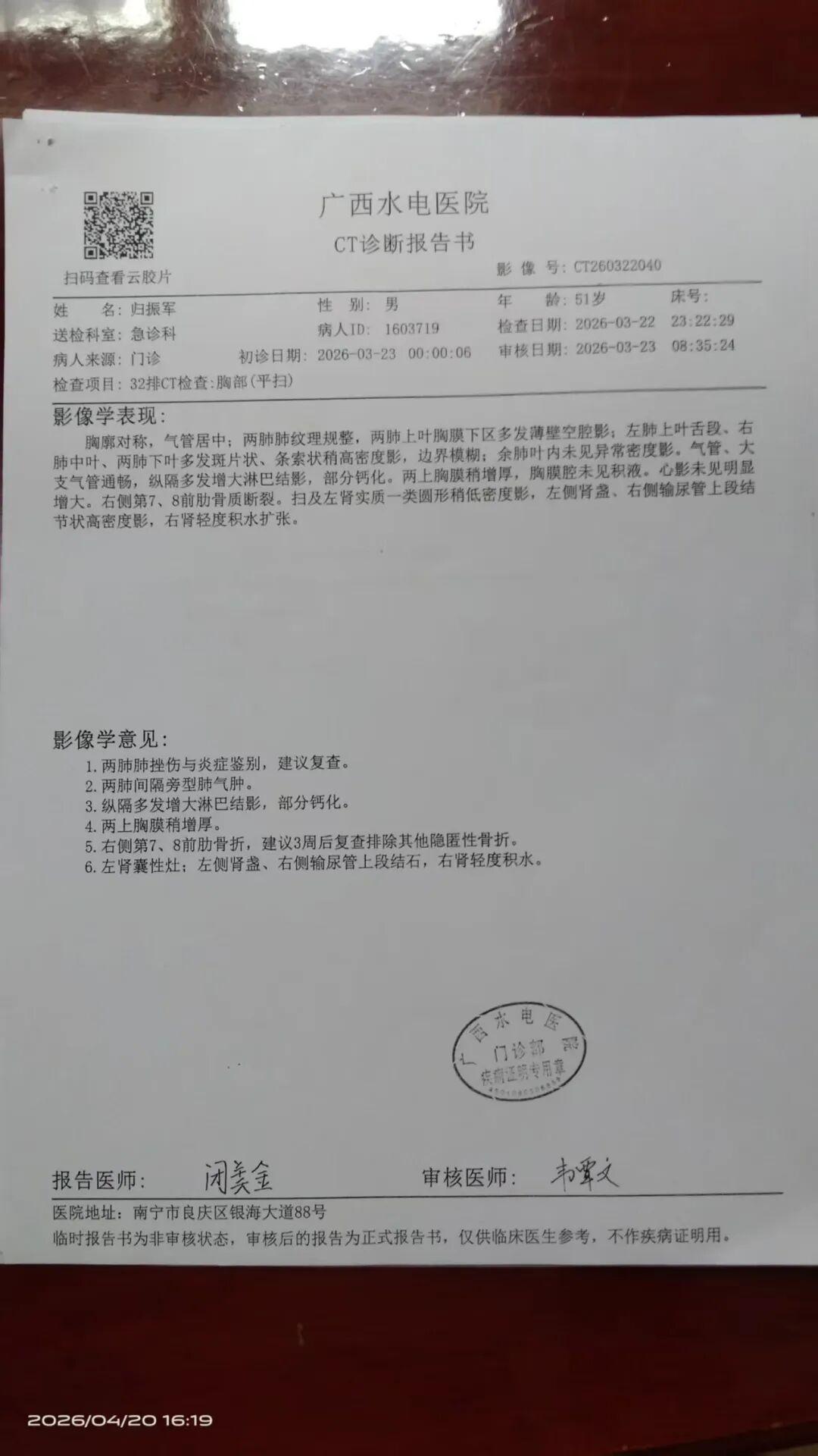 柠檬直播体育-南宁一群众到法院申请立案被法警群殴断两根肋骨！警方：不予立案
